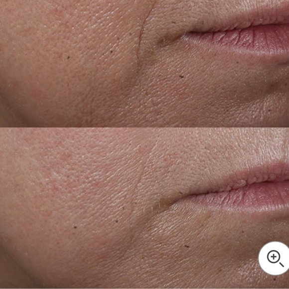 NWT PERRICONE MD COLD PLASMA PLUS ADVANCED Facial SERUM CONCENTRATE 0.5 oz. - Picture 6 of 6